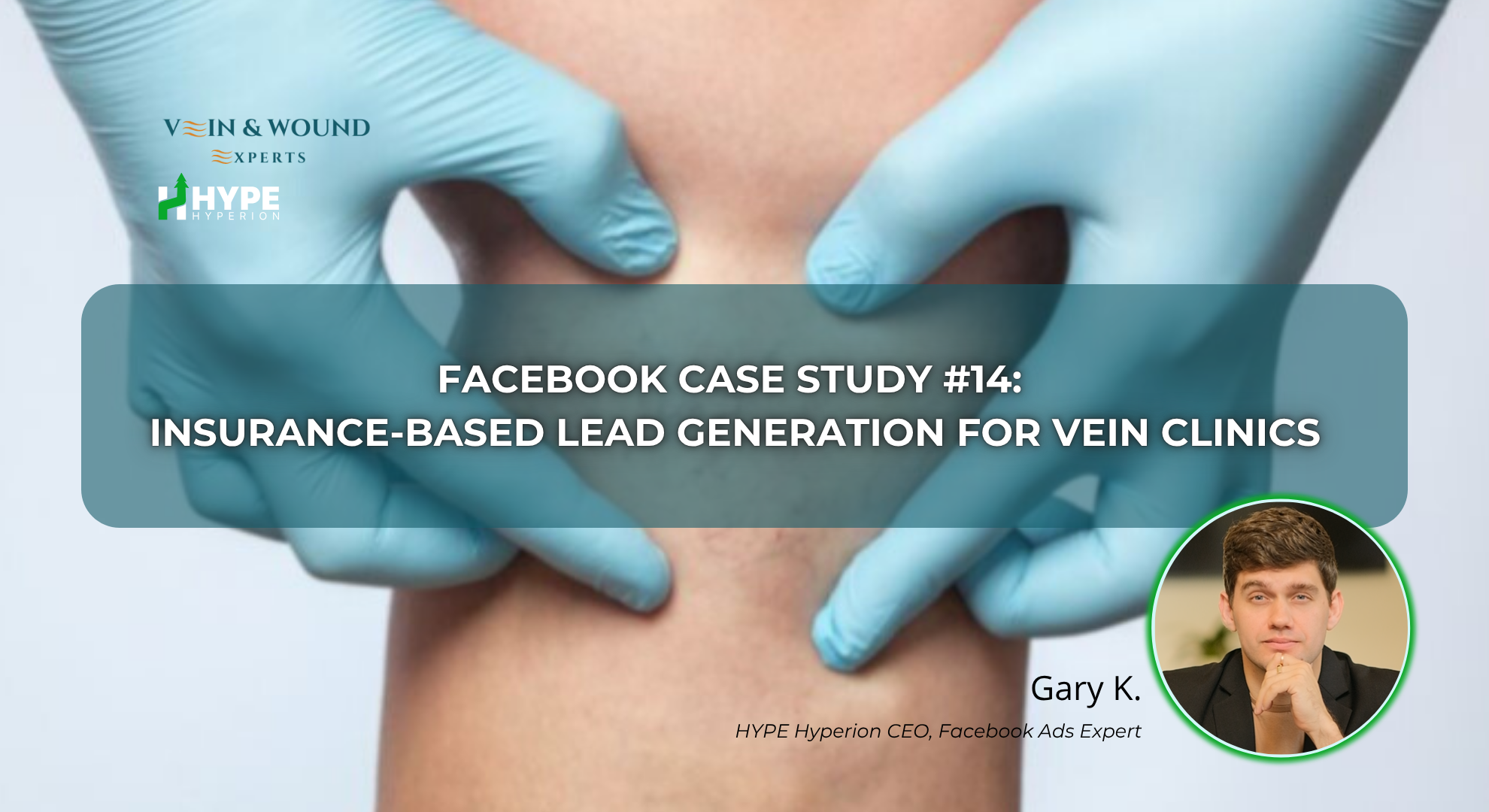 vein clinic facebook ads