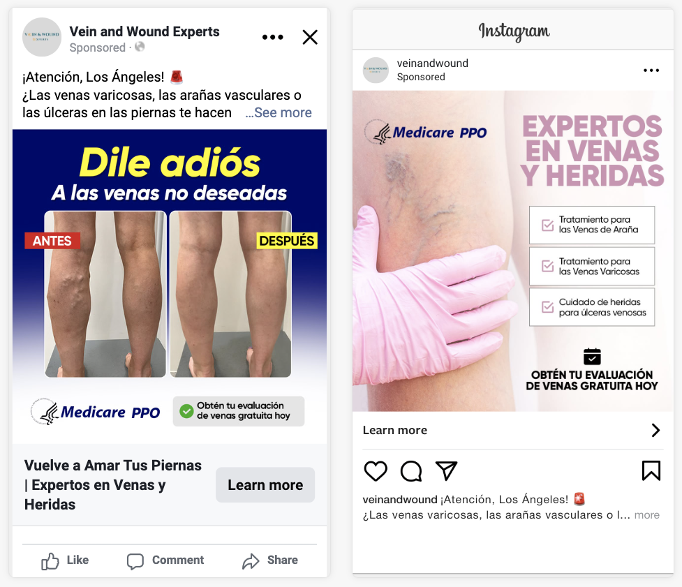Vein Clinic Ads Example-2